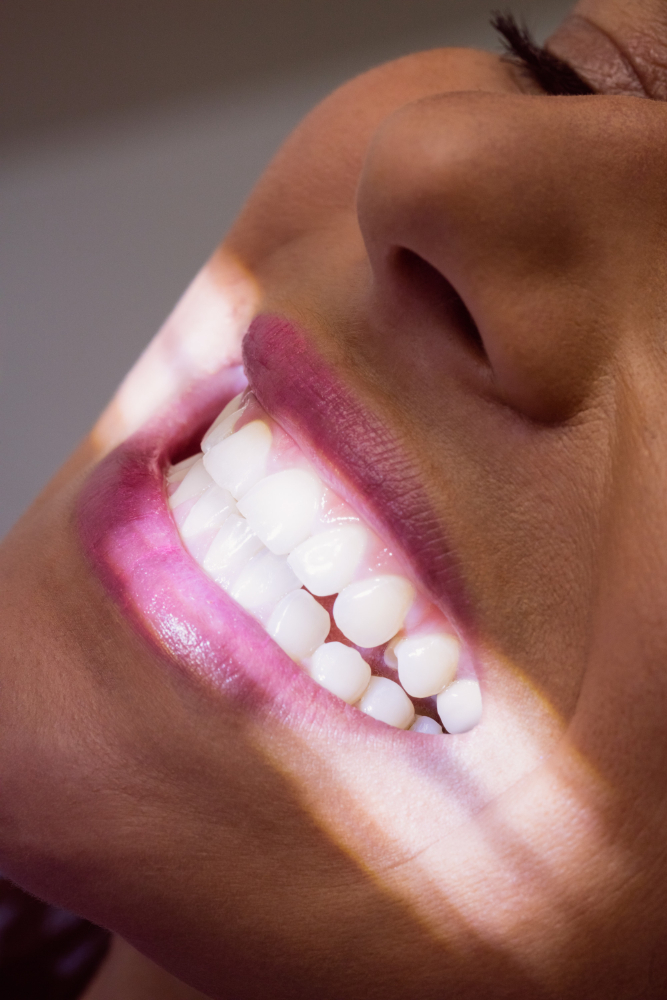 Lakierowanie zębów – uniwersalny zabieg prewencyjny